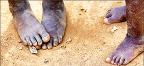 Feet of african children